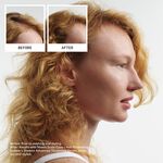 Nioxin System 1 Pro Clinical Kit d'Essai