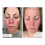 Stylpro Wavelength Masque visage LED