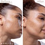 Stylpro Dermaplane Sonique 2-en-1