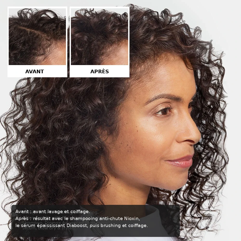 Nioxin Anti-Hair Loss Shampoo before and after image